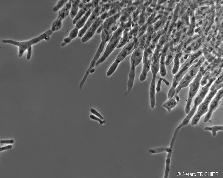 Poliporacea